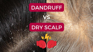 dandruff vs dry scalp blog