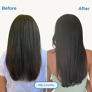 Nourishing follicle stimulator for hair growth Before and after comparison of a woman's long, straight dark brown hair from the back, showing smoother, shinier results after 2 months. The left side is labeled 'Before' and the right side 'After' in blue text.